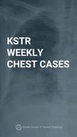 پوستر KSTR Weekly Chest Cases