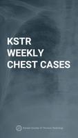 KSTR Weekly Chest Cases poster