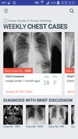 برنامه‌نما KSTR Weekly Chest Cases عکس از صفحه