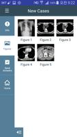 KSTR Weekly Chest Cases screenshot 3