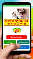 মুখের দূর্গন্ধ দুর করার উপায় ~ Mouth Treatment Cartaz