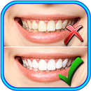 How to Whiten Teeth at home APK
