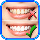 How to Whiten Teeth icône