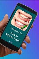 How to Whiten Teeth Affiche