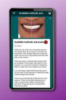 How to Whiten Teeth 截图 3