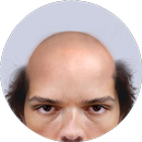 Bald Face APK