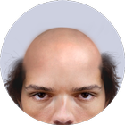 Bald Face icon