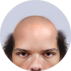 Bald Face Zeichen
