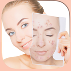 Pimple Remover-Face Enhancer icône