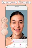 Pimple Remover-Face Enhancer Affiche