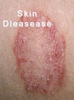 All skin diseases постер