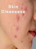 All skin diseases скриншот 1