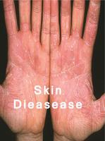 All skin diseases скриншот 2