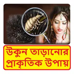 মাথায় উকুন নো টেনশন ~ Hair Treatment APK download