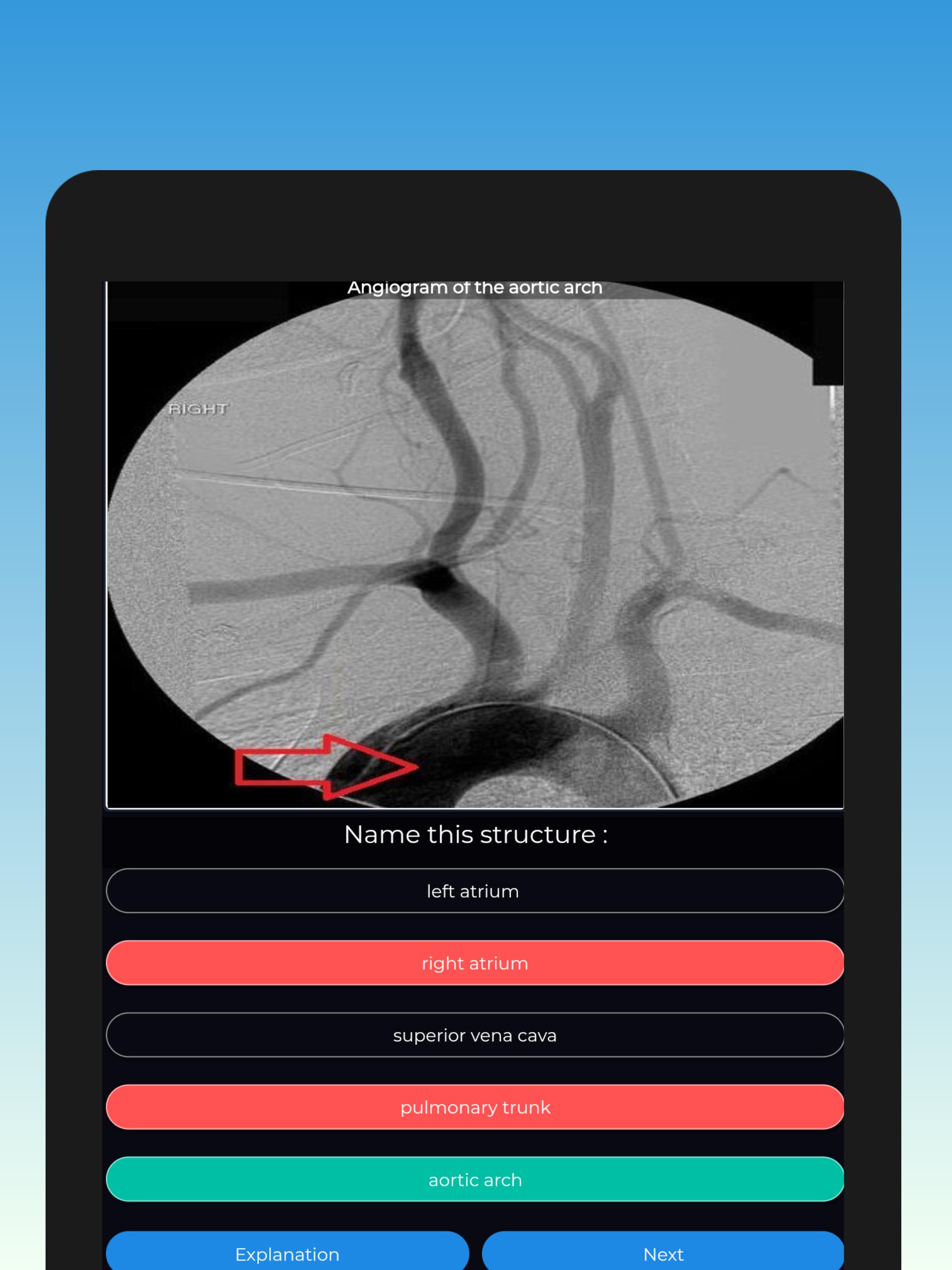 Frcr Radiological Anatomy Flashcards Mcqs For Android Apk Download