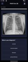 FRCR Part2B (short case) poster