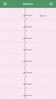 iBP ECG Pro screenshot 1