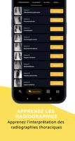 Radiographie Pulmonaire capture d'écran 1