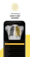 Chest Xray Academy | CXR Cases ポスター