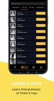 Chest Xray Academy | CXR Cases screenshot 1