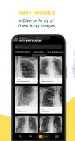 Chest Xray Academy | CXR Cases スクリーンショット 2