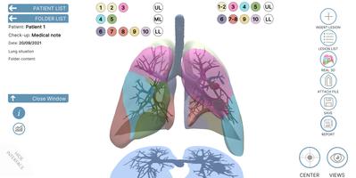 LUNG-NOTE imagem de tela 1