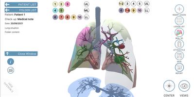 LUNG-NOTE imagem de tela 2