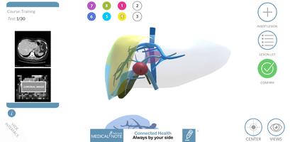 LIVER-NOTE.Edu 스크린샷 3