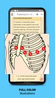 ECG Interpretation: Pkt Guide ảnh chụp màn hình 2