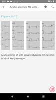 Swanton's Cardiology Guide screenshot 3