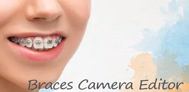 Braces Camera Editor