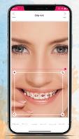 Braces Camera Editor پوسٹر