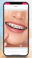 برنامه‌نما Braces Camera Editor عکس از صفحه