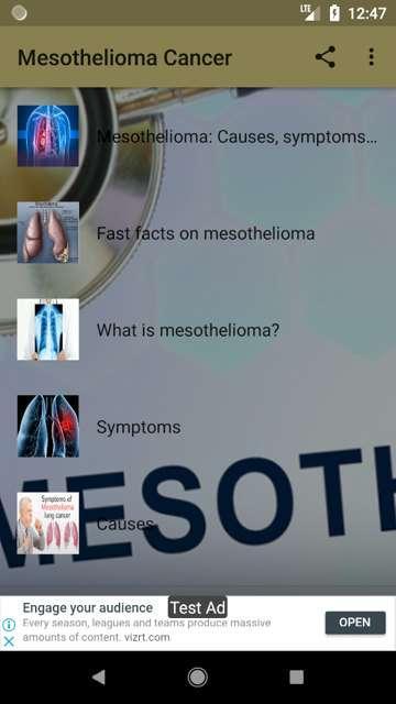 malignant pleural mesothelioma radiation