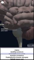MIS Human Body AR Poster تصوير الشاشة 3