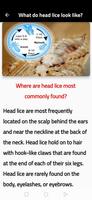 Head lice removal guide capture d'écran 1