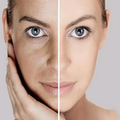 Skin whitening