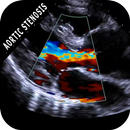 AORTIC STENOSIS PROTOCOL GUIDE APK