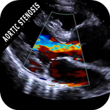 AORTIC STENOSIS PROTOCOL GUIDE ícone