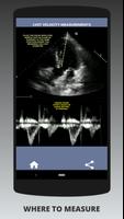 AORTIC STENOSIS PROTOCOL GUIDE imagem de tela 1