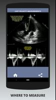 AORTIC STENOSIS PROTOCOL GUIDE capture d'écran 1