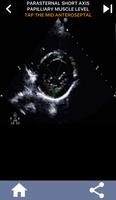 ECHO HEART WALL SEGMENTS QUIZ imagem de tela 2