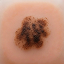 Holey Mole - Scan and Track aplikacja