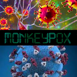 Monkeypox