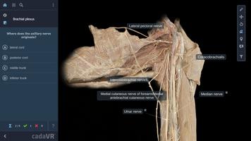 cadaVR anatomy capture d'écran 1