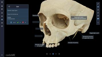 cadaVR anatomy capture d'écran 2