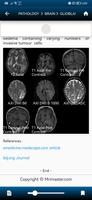 MRI MASTER 포스터