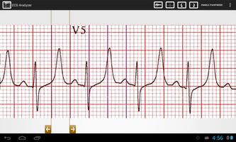 ECG Analyzer পোস্টার