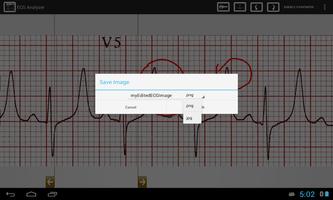 ECG Analyzer স্ক্রিনশট 2