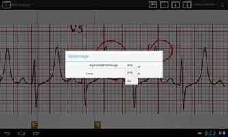 2 Schermata ECG Analyzer